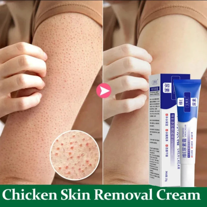 Curing Keratosis Pilaris Chicken Follicle Skin