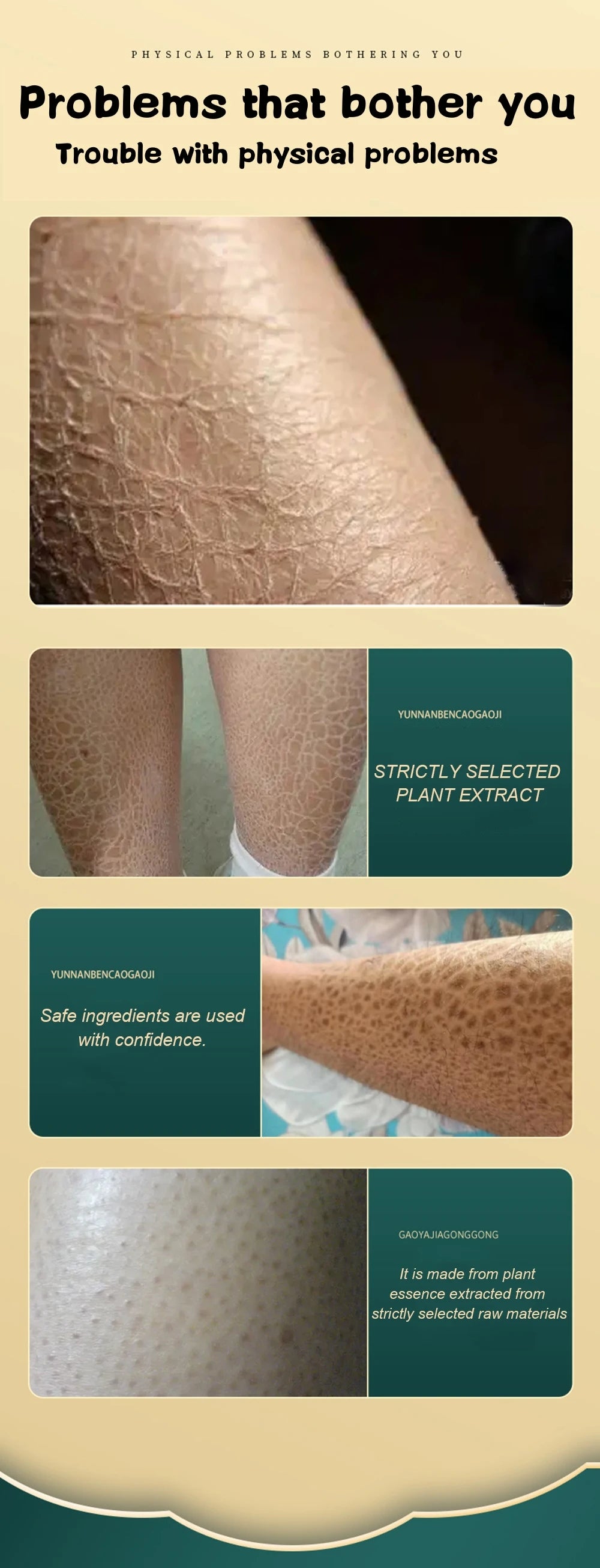 Curing Keratosis Pilaris Chicken Follicle Skin
